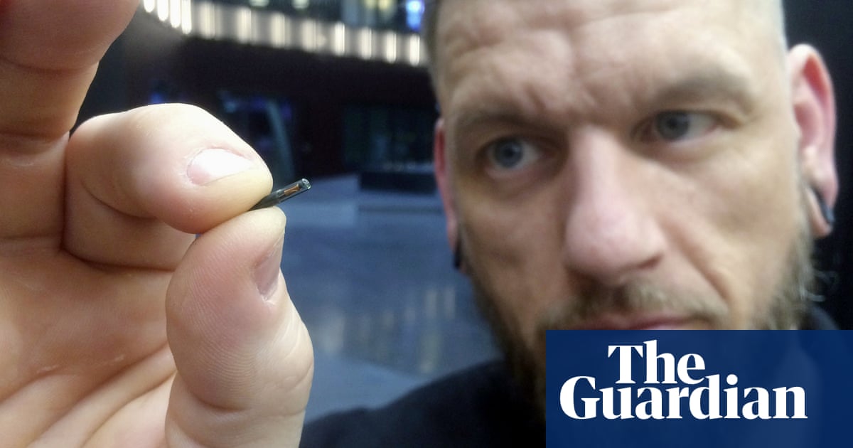 Under the skin how insertable microchips could unlock the future