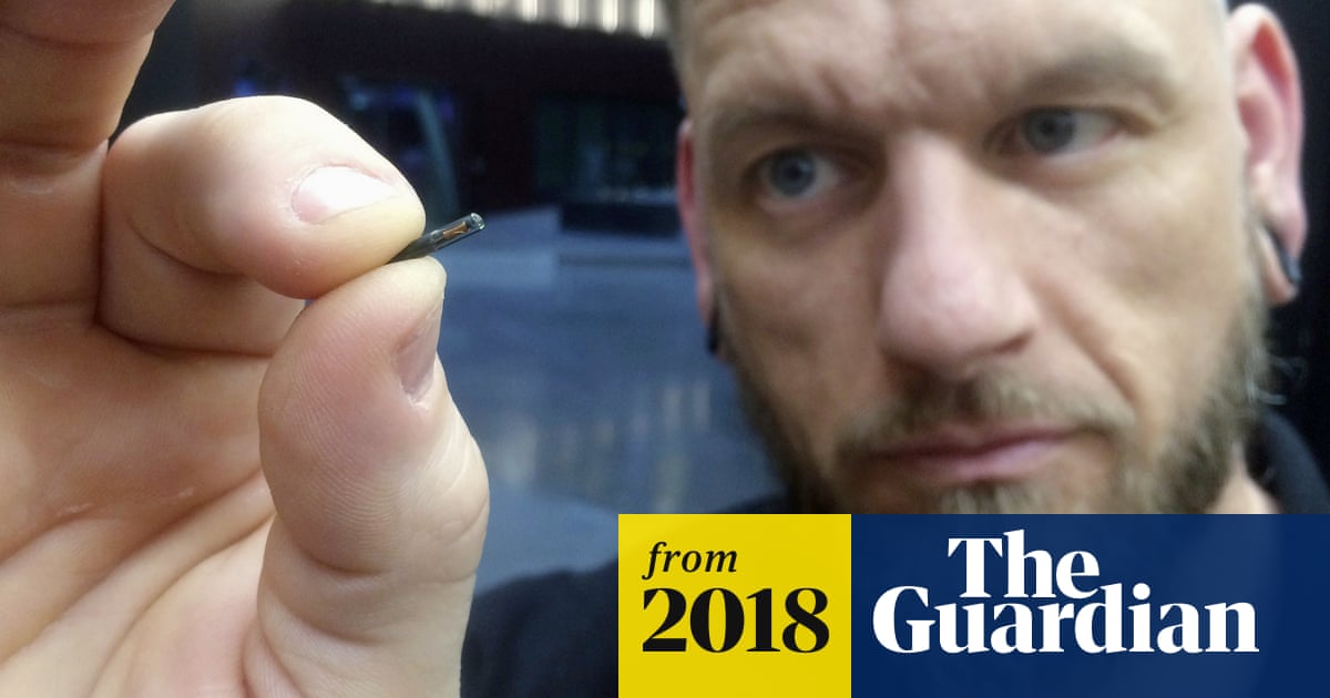 Alarm over talks to implant UK employees with microchips
