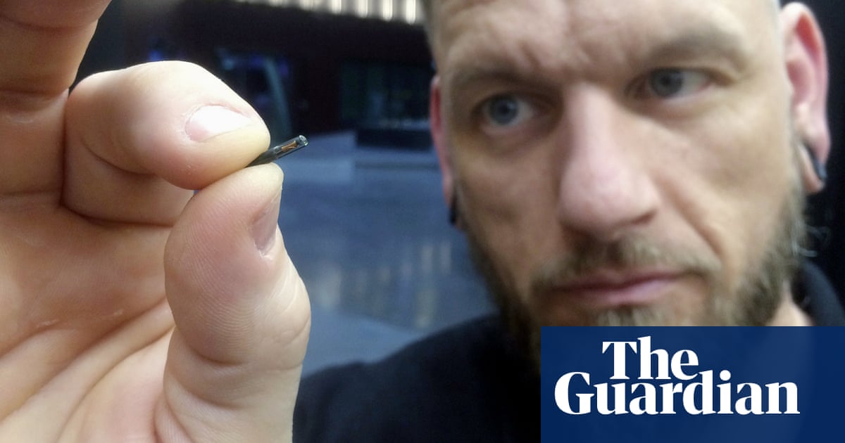 Alarm over talks to implant UK employees with microchips