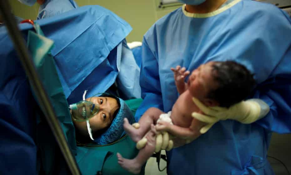 Yang Huiqing looks at her baby after a cesarean section in Ruijin Hospital in Shanghai.