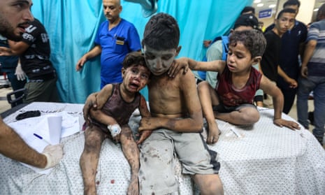 Gazans Await Aid As Israel's Siege ContinuesKHAN YUNIS, GAZA - OCTOBER 24: (EDITOR'S NOTE: Image depicts graphic content/injury detail) Palestinians injured in Israeli air raids arrive at Nasser Medical Hospital on October 24, 2023 in Khan Yunis, in the southern Gaza Strip, Gaza. Two weeks after a deadly Hamas attack in southern Israel that sparked a retaliatory siege of Gaza, in which thousands have died and hundreds of thousands have been displaced, aid trucks have started entering the Palestinian territory via Egypt carrying food, water and medicines. The UN agency UNRWA, or the Relief and Works Agency for Palestine Refugees, says the initial aid is a "drop in the ocean" of what is needed. (Photo by Ahmad Hasaballah/Getty Images)