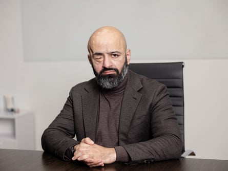 A solemn-looking man pinch a beard and shaved caput successful a overgarment looks astatine nan camera. One oculus is missing and nan eyelids person been sewn unopen