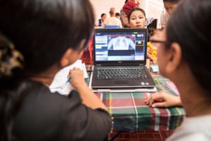Healthcare workers look at a chest x-ray in TB clinic, Thangita, Myanmar