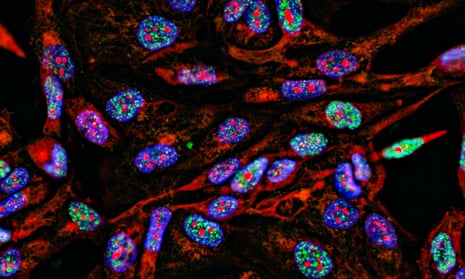 Fluorescent Imaging of cancer cells
