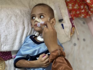 A person dabs Omar's mouth with a cloth as he lies on a hospital bed and looks around him
