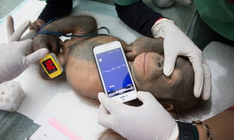 After putting the 18-month-old orangutan, Didik, under anesthesia, the vets check a portable heart monitor which works with a smart phone. The ECG recorder enables the vets to monitor the heart rate of Didik during the operation. 