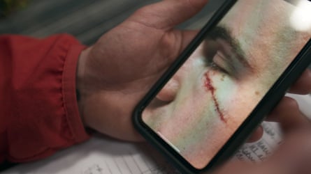 Aodh Breathnach’s injuries from Scars: Surviving a Stabbing
