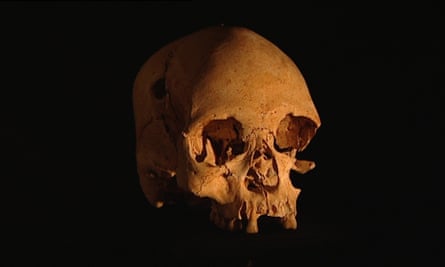 The 11,500-year-old skull of the Luzia Woman, the oldest skull to be discovered on the American continent.