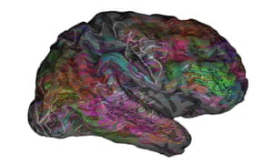One person’s right cerebral hemisphere. The overlaid words, when heard in context, are predicted to evoke strong responses near the corresponding location. Green words are mostly visual and tactile, red words are mostly social.