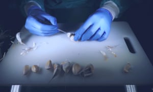 Dissection of a Garlic Bulb, by the Food Surgeon.