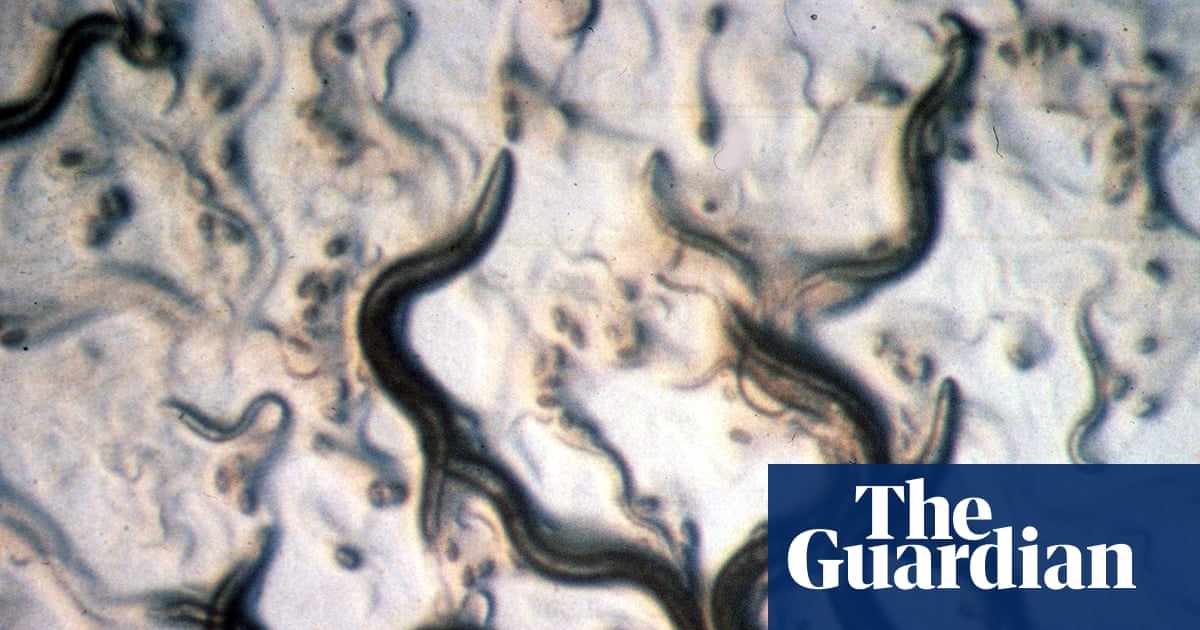 Does it even need to be said? No, you don’t need to do a ‘parasite cleanse’