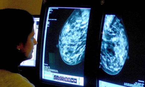 A consultant analysing a mammogram.