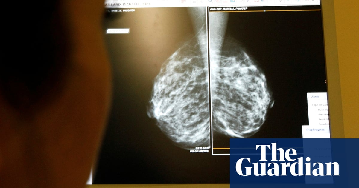 Women in England with breast cancer may qualify for drug that buys ‘precious’ time