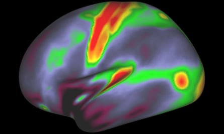 A map of myelin content (red, yellow are high myelin; indigo and blue are low myelin) in the left hemisphere of the brain.
