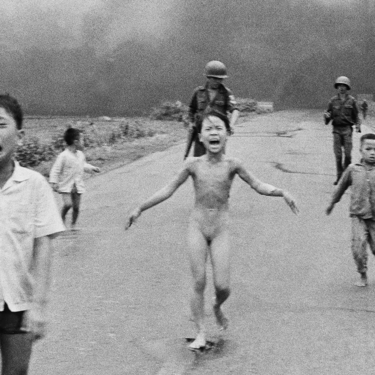 Vietnam War S Napalm Girl Kim Phuc Has Laser Treatment To Heal Wounds Us News The Guardian Vietnam War S Napalm Girl Kim Phuc Has Laser Treatment To Heal Wounds Us News The Guardian