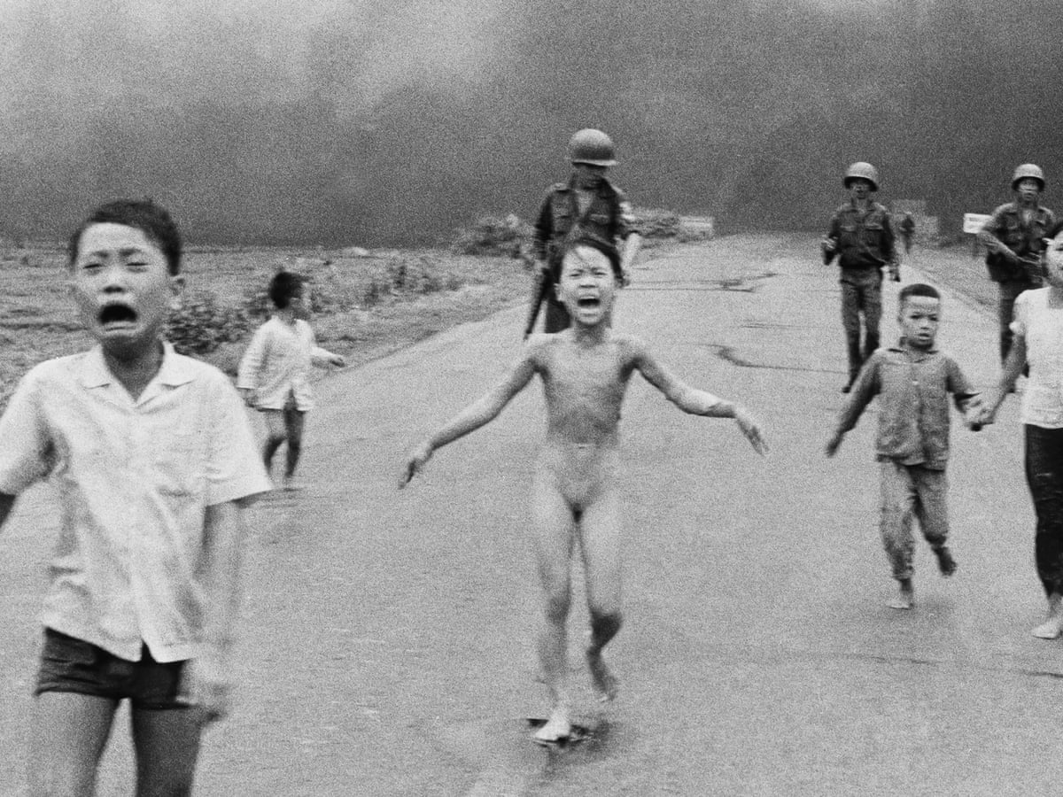 Vietnam War S Napalm Girl Kim Phuc Has Laser Treatment To Heal Wounds Us News The Guardian Vietnam War S Napalm Girl Kim Phuc Has Laser Treatment To Heal Wounds Us News The Guardian