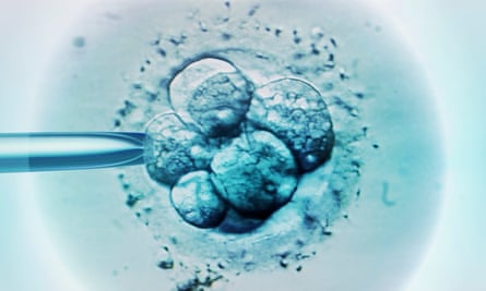 Eggs illuminated in blue light by seen under a microscope as part of an IVF procedure