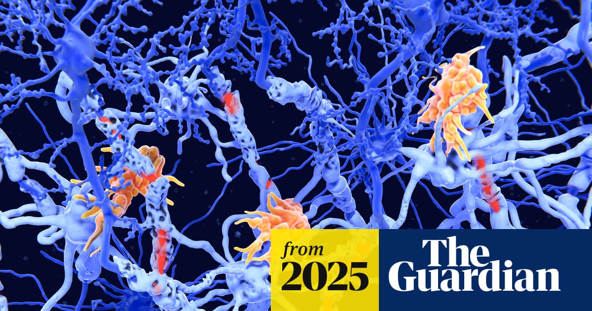 ‘Inverse vaccines’: the promise of a ‘holy grail’ treatment for autoimmune diseases