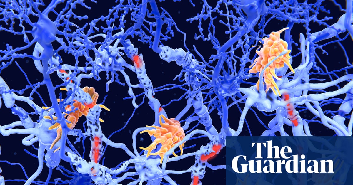 Exciting' clinical results offer hope for new class of MS therapies