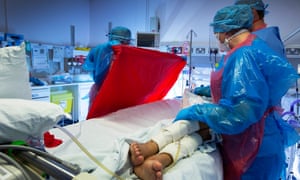 Intensive care at the Western General Hospital, Edinburgh, Scotland.