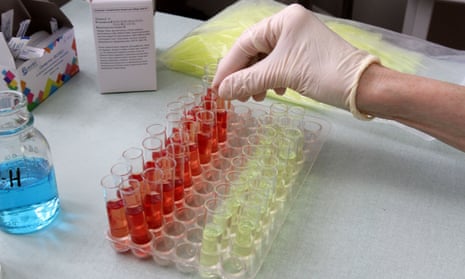 Blood testing equipment