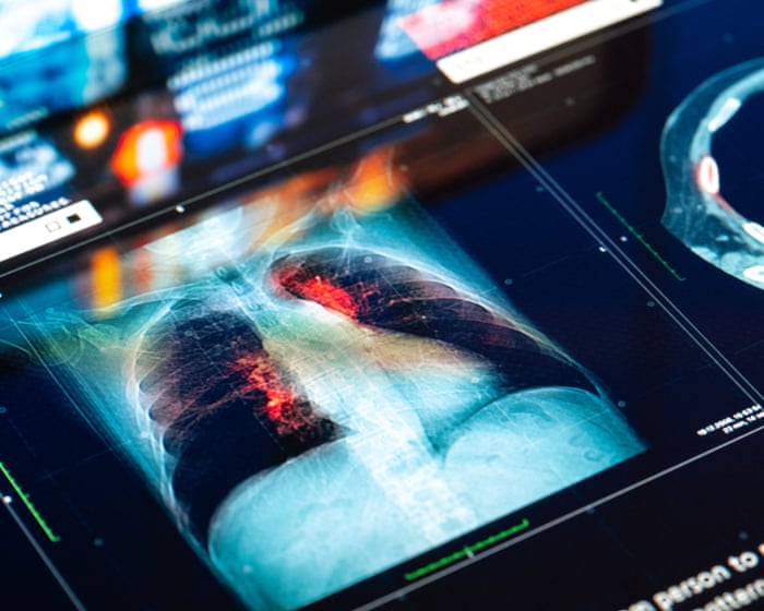Doctors and NHS could be sued for mistakes made by AI tools, report warns