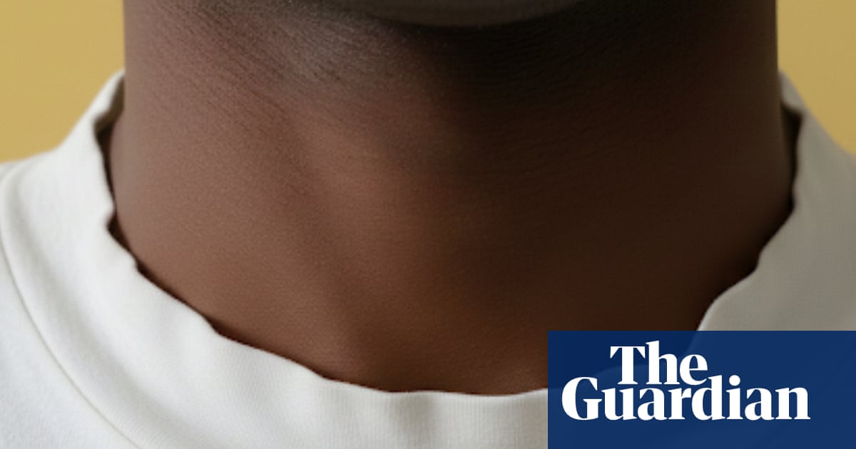 A cure for ‘bacon neck’: How to keep your T-shirts in top shape