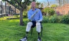 Tory MP Craig Mackinlay reveals his hands and feet have been amputated due to sepsis