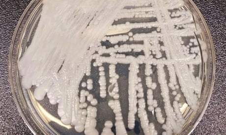 Candida auris: deadly fungal infections spreading across US at ‘worrisome’ rate