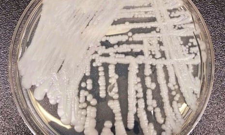 a strain of Candida auris cultured in a petri dish at a CDC laboratory.