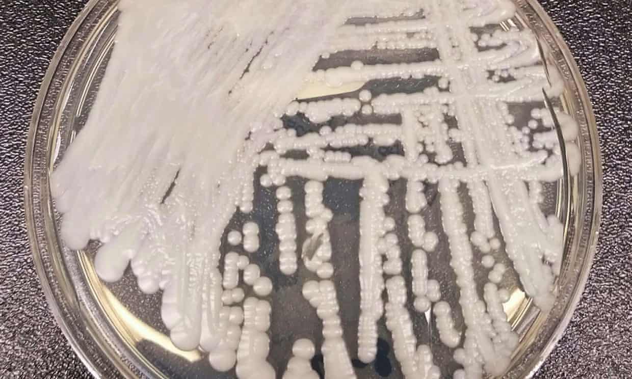 Candida auris