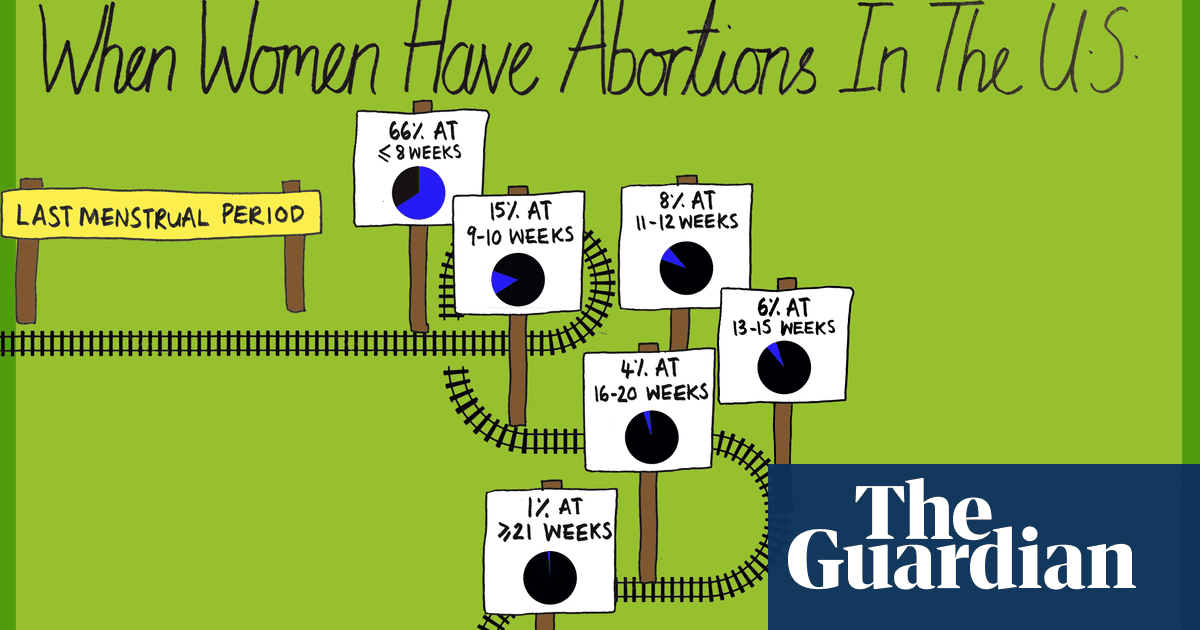 The truth about lateterm abortions in the US they're very rare
