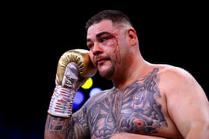 Ruiz Jr rseems troubled by the cut to his left eye.