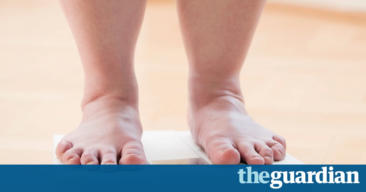 Global cost of obesity-related illness to hit $1.2tn a year from 2025 10