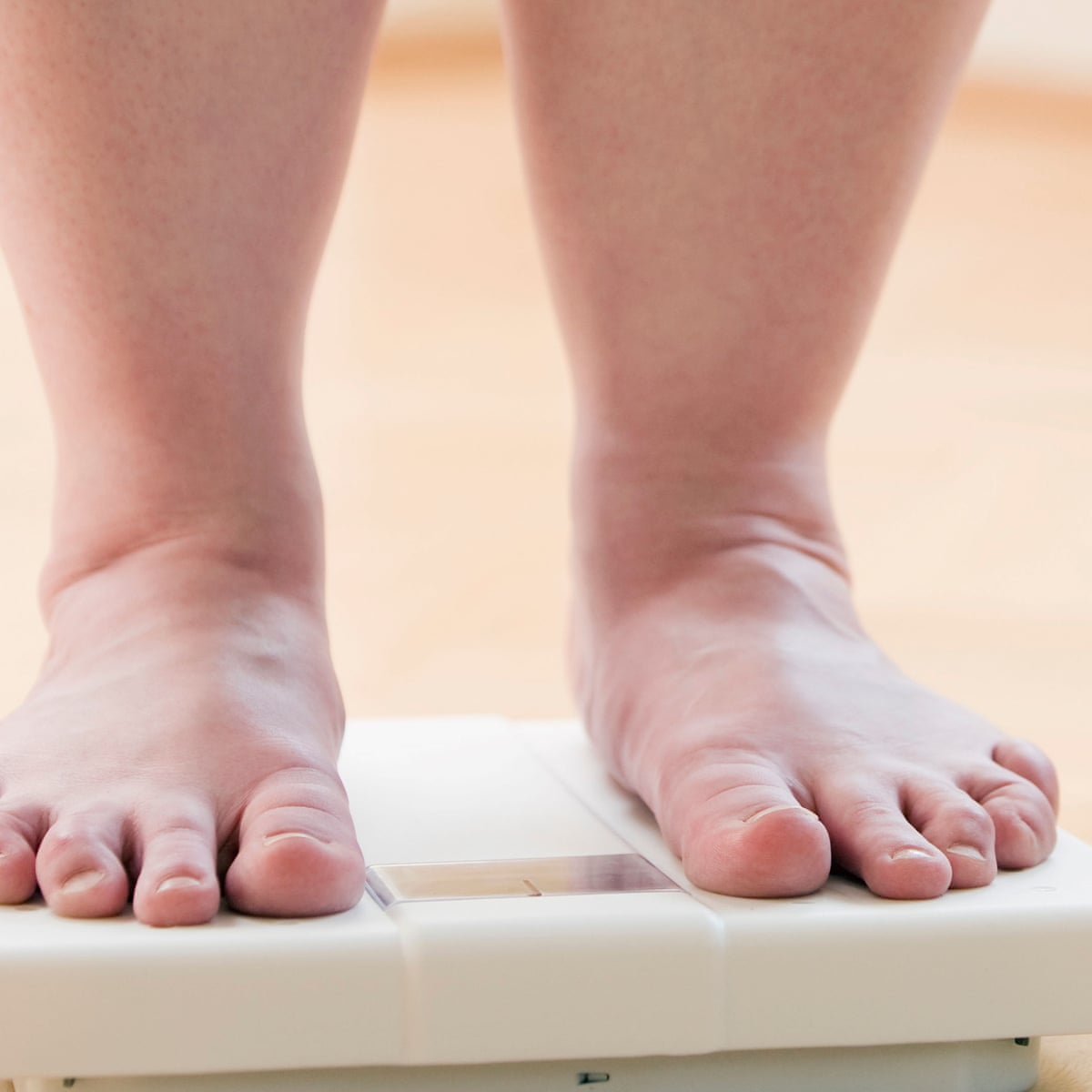 Radical Diet Can Reverse Type 2 Diabetes New Study Shows