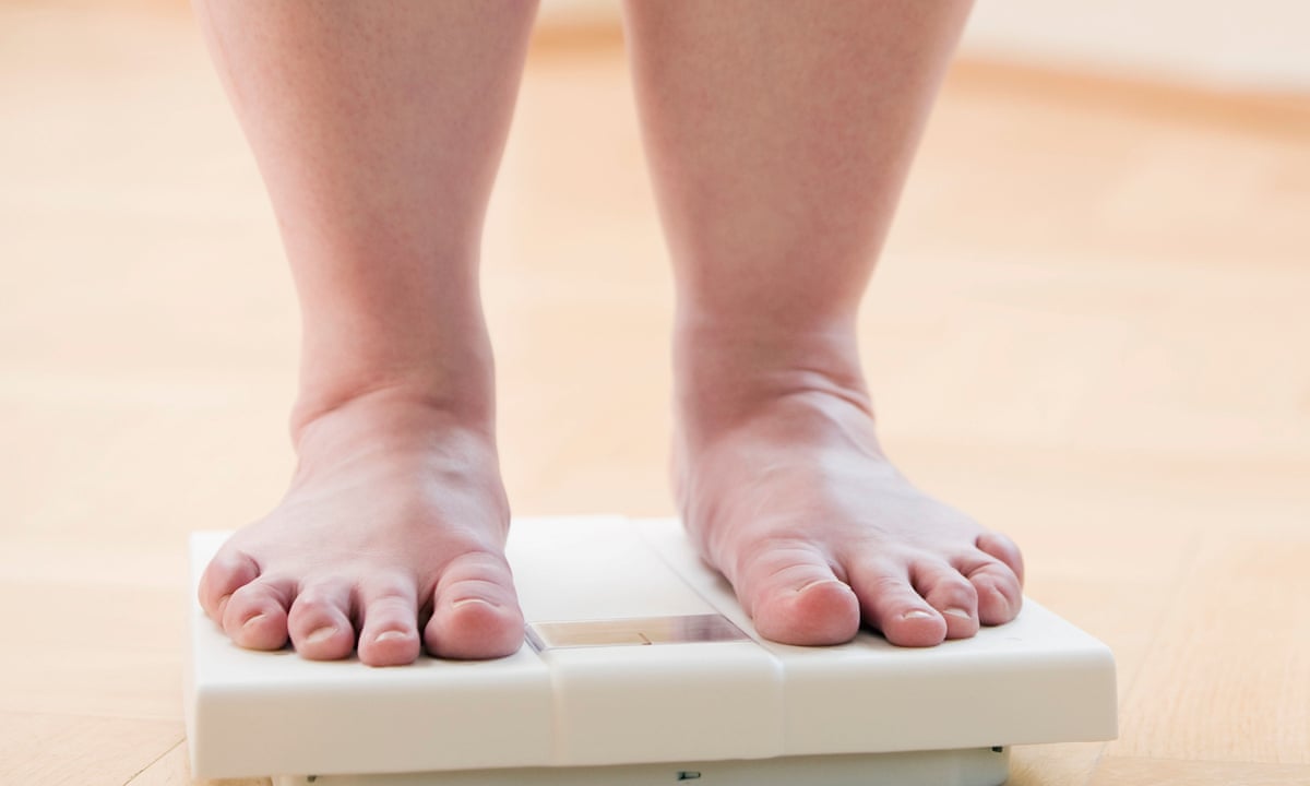 Global cost of obesity-related illness to hit $1.2tn a year from 2025 | Obesity | The Guardian