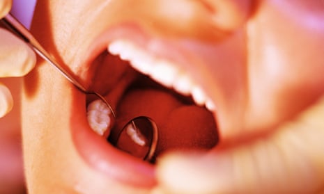 Labour pledges to scrap dental checkup fees | Labour | The Guardian