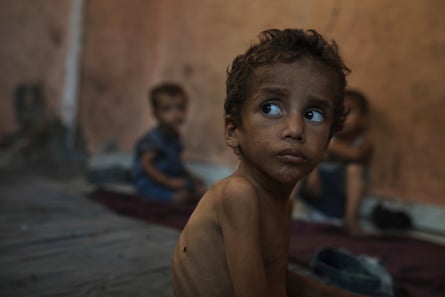 An extremely thin boy, with two other children in the background