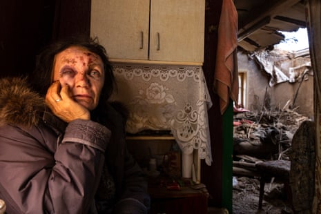 Leda Buzinna, 56 years-old, sits inside her home that was seriously damaged by shelling overnight on 4 October outside of Kramatorsk district.