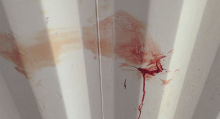 A bloodied wall, the aftermath of a riot on Manus Island