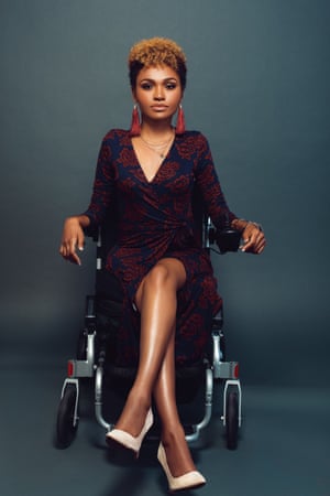 A model with scoliosis and paralysis, as styled by Stephanie Thomas of Cur8able