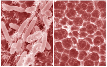 Ideonella sakaiensis (left) and the degraded remains of plastic it had ‘eaten’ (right).