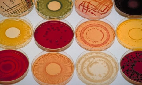  A variety of bacterial cultures grow in petri dishes at pharmaceutical company Aventis Pasteur
