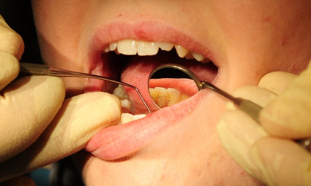 A dentist examining a child's teeth