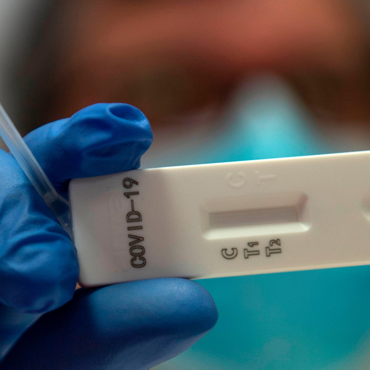Coronavirus Antibody Tests What They Are And How They Work