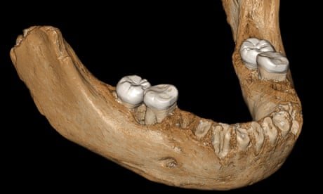 The Denisovan mandible likely represents the earliest hominin fossil on the Tibetan Plateau