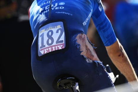 Clement Berthet, injured after a Tour de France TTT crash