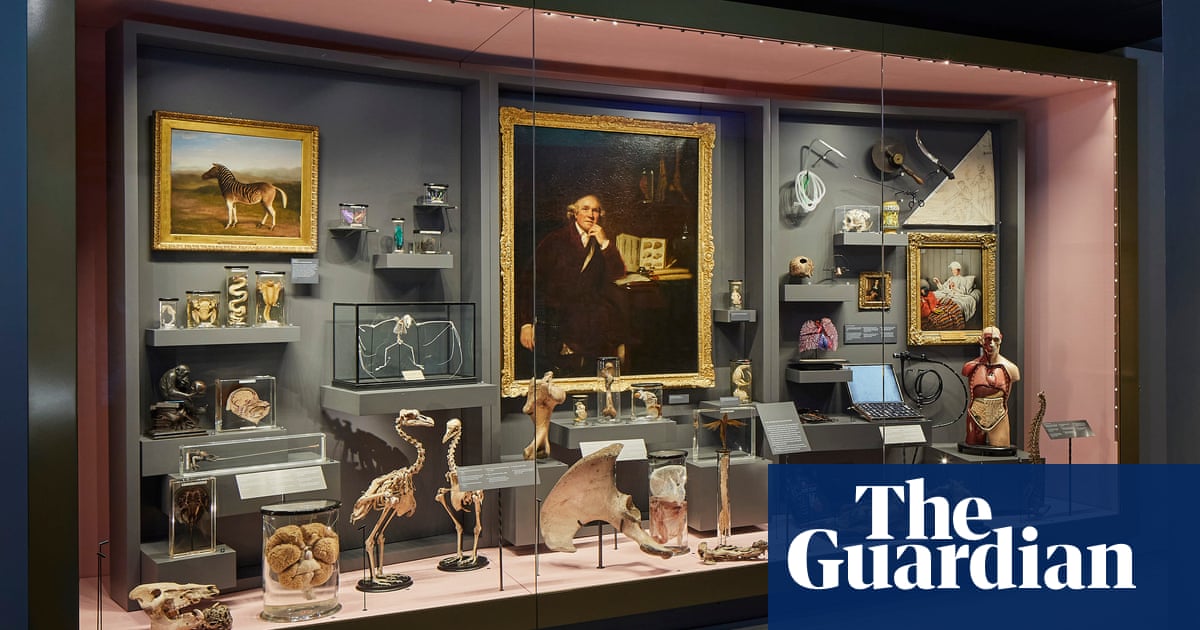 From foetuses to penises: anatomical museum reopens in London