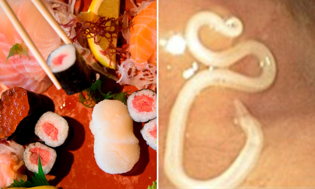 Popularity of sushi has brought rise in parasitic infections, warn doctors | Food safety | The Guardian