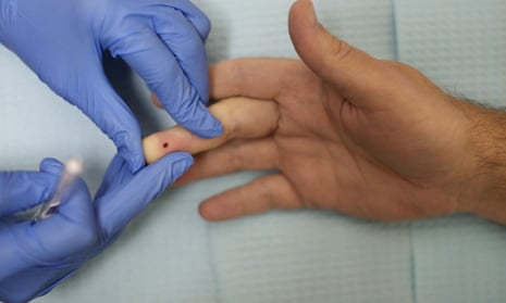 A man being given a finger-prick HIV test